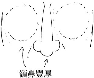 颧丰鼻厚